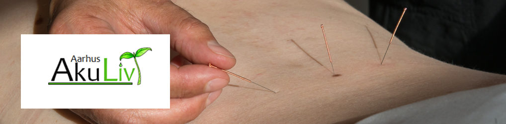 Kinesisk Akupunktur og Fysioterapi